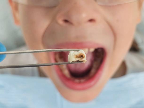 Best Same-Day Emergency Dentist in East Rockingham, NC